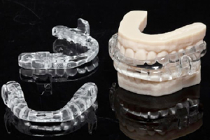 Treatment with a Custom Oral Appliance